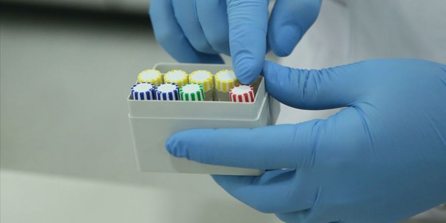 İran'da Kovid-19 teşhis kiti üretilmeye başlandı