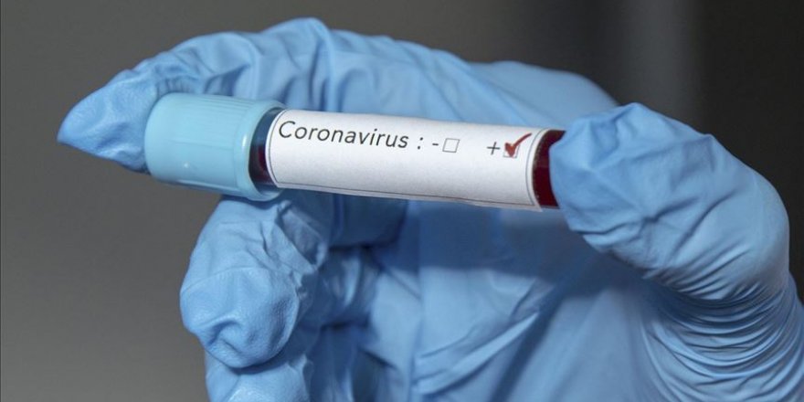 Dünyada Kovid-19 nedeniyle ölenlerin sayısı 18 bin 900'ü aştı