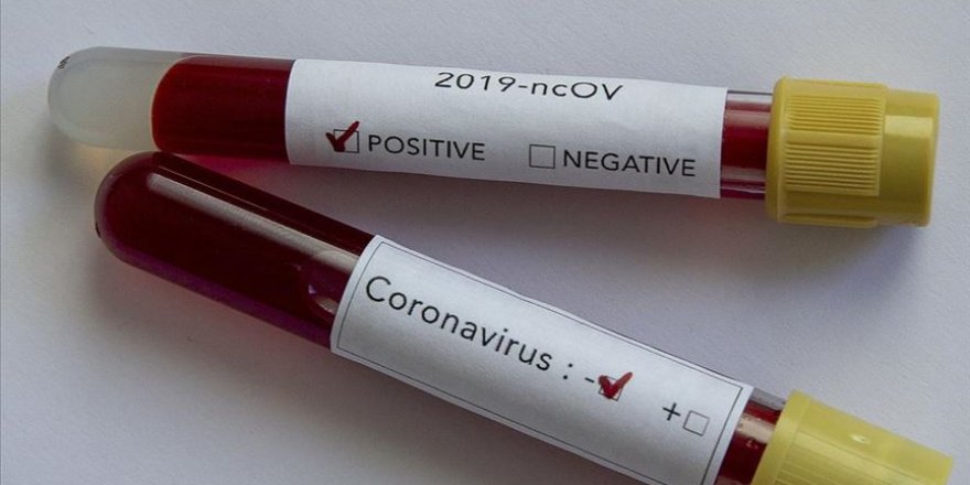 Koronavirüs sindirim yoluyla bulaşmıyor