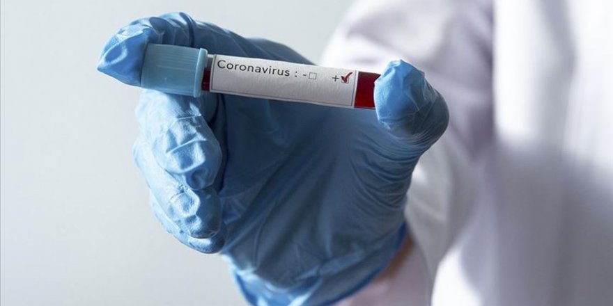 Kovid-19 nedeniyle ölenlerin sayısı dünya genelinde 30 bini aştı