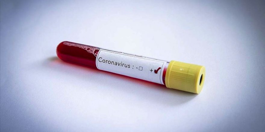 ABD'de Kovid-19 belirtileriyle gittiği acil servise alınmayan sigortasız genç hayatını kaybetti