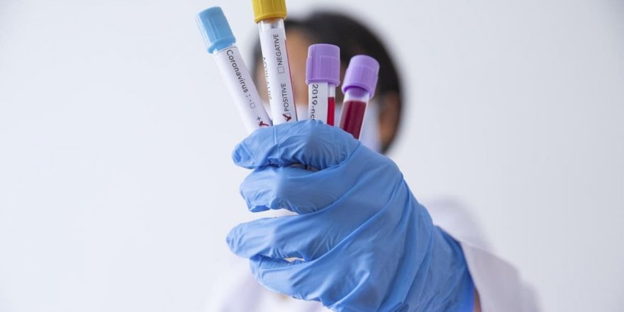 "Hızlı tanı kiti"nin geliştirilebilmesi için seferber oldular