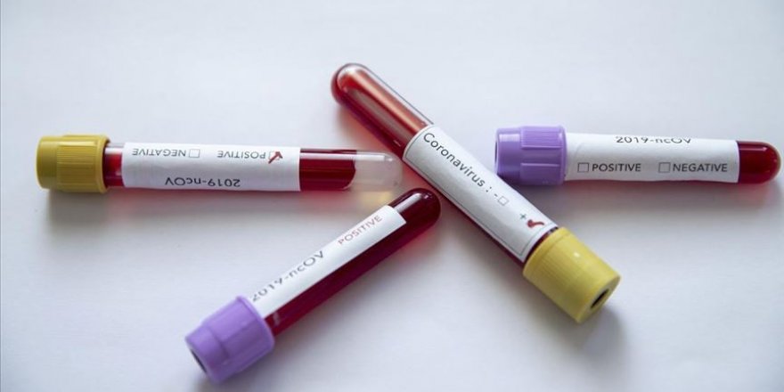 Afrika'nın 6 ülkesinde henüz Kovid-19 vakası görülmedi