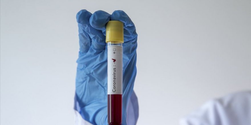 Avrupa'da Kovid-19 nedeniyle 108 Türk hayatını kaybetti