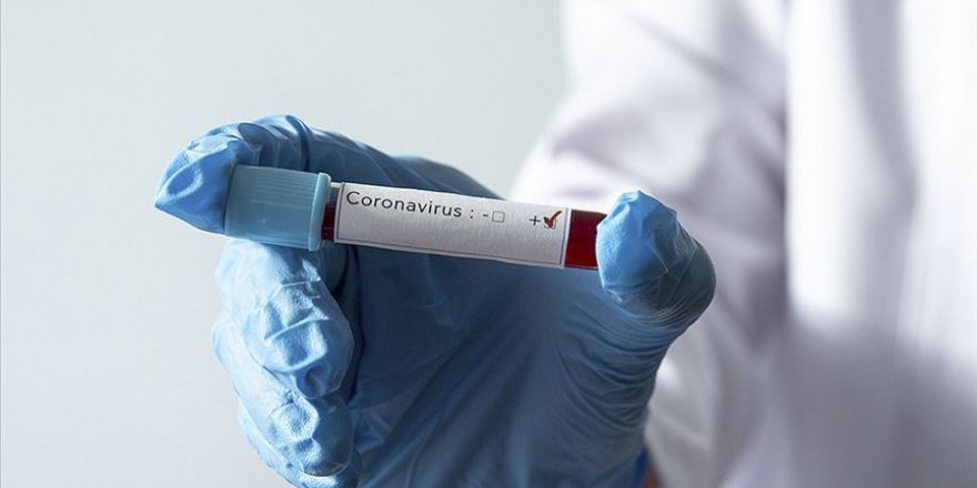 İran'da iki haftalık bir bebekte Kovid-19 tespit edildi