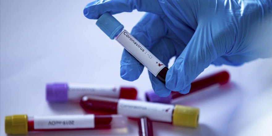 ABD'nin Maryland eyaletinde 5 bebekte Kovid-19 tespit edildi