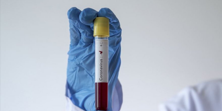 Türkiye'de Kovid-19'dan iyileşen hasta sayısı 786'ya ulaştı