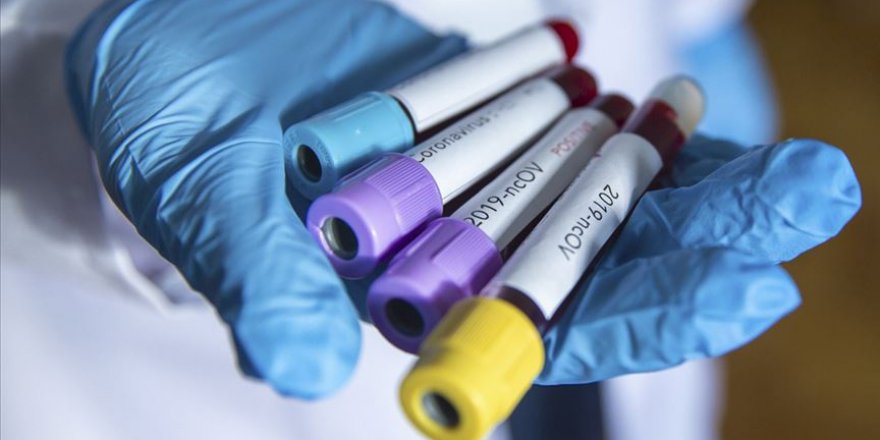 Dünya genelinde koronavirüsten şifa bulan kişi sayısı 250 bini geçti