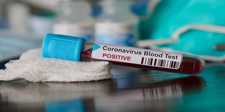 Almanya'da 3 Türk vatandaşı daha Kovid-19 nedeniyle hayatını kaybetti