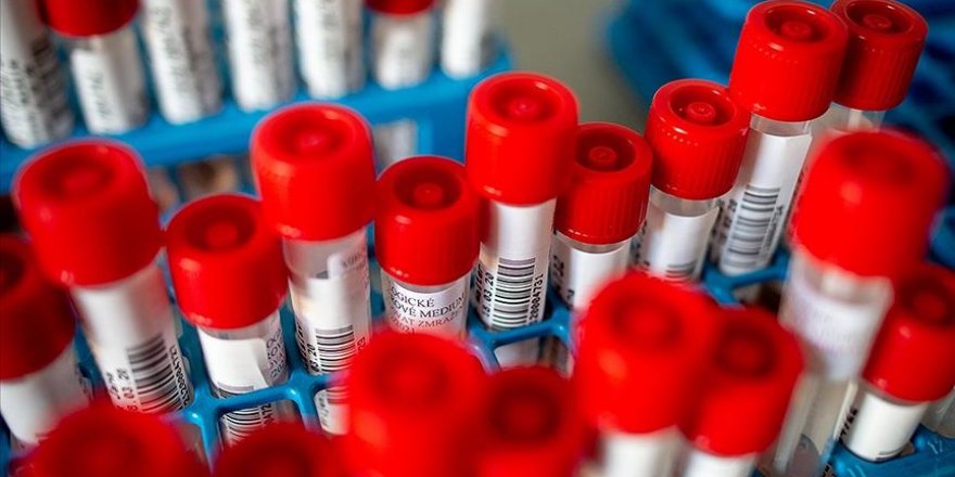 Sağlık Bakanlığı Referans Laboratuvarı'nda Kovid-19 virüsü izole edildi