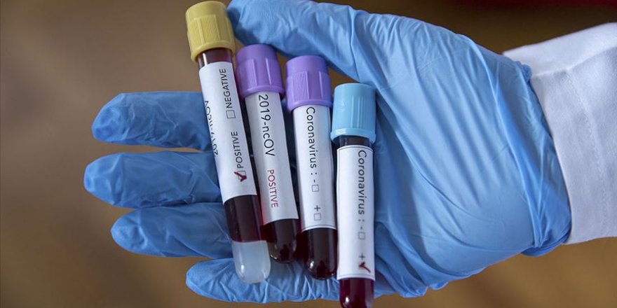 Koronavirüste mayısta gerileme beklentisi