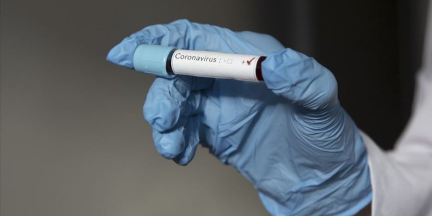 Atık sulardaki virüs partiküllerinden Kovid-19 vaka sayısının bulunabileceği iddia edildi