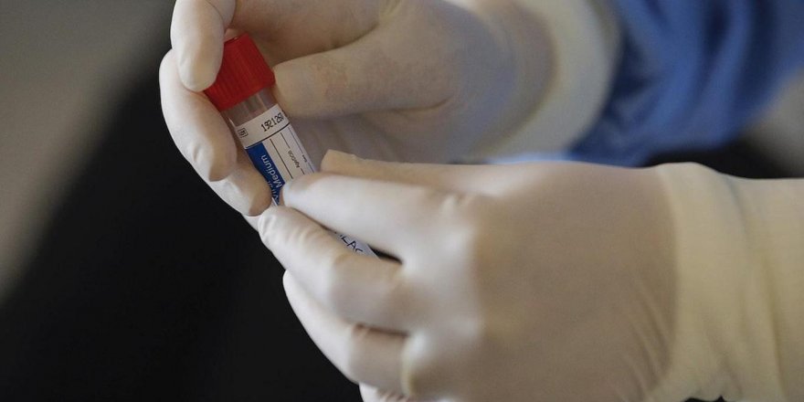 Dünyada Coronavirus'ten iyileşenlerin sayısı 400 bini aştı