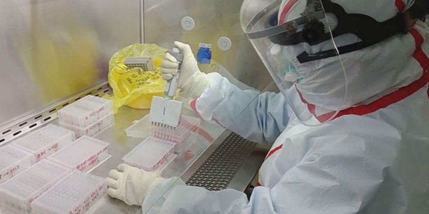 Sağlık çalışanlarını Kovid-19'dan korumak için 'örnek alma kabini' geliştirdiler