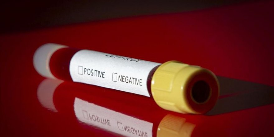 Türkiye'de koronavirüs artış hızı kırıldı