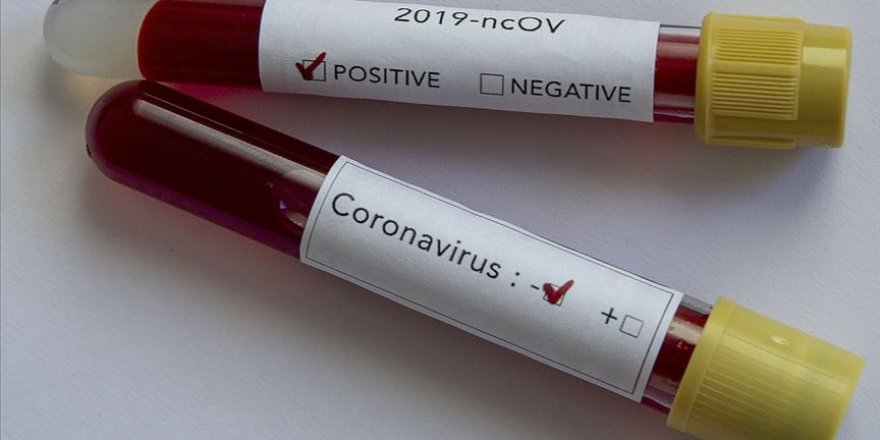 Antalya'da plazma nakledilen hastanın testi negatife döndü