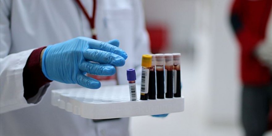 Dokuz Eylül Üniversitesinde 'immun plazma' tedavisi başladı