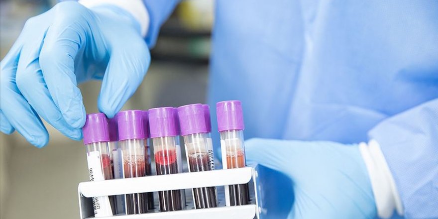 Çukurova Üniversitesi Kovid-19 tedavisinde alternatif yeni bir etken madde geliştirdi