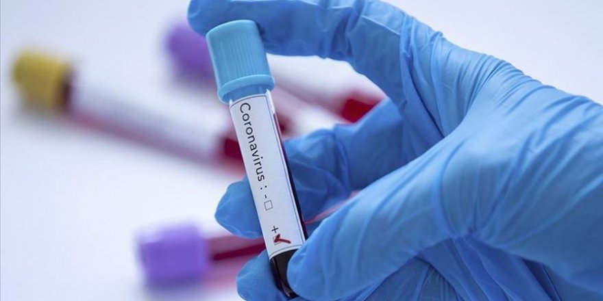 Koronavirüsü erken tespit edecek kit geliyor