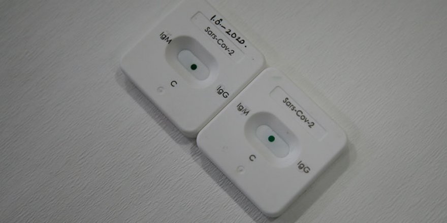 Yeni tip koronavirüs 5 dakikada test edilecek