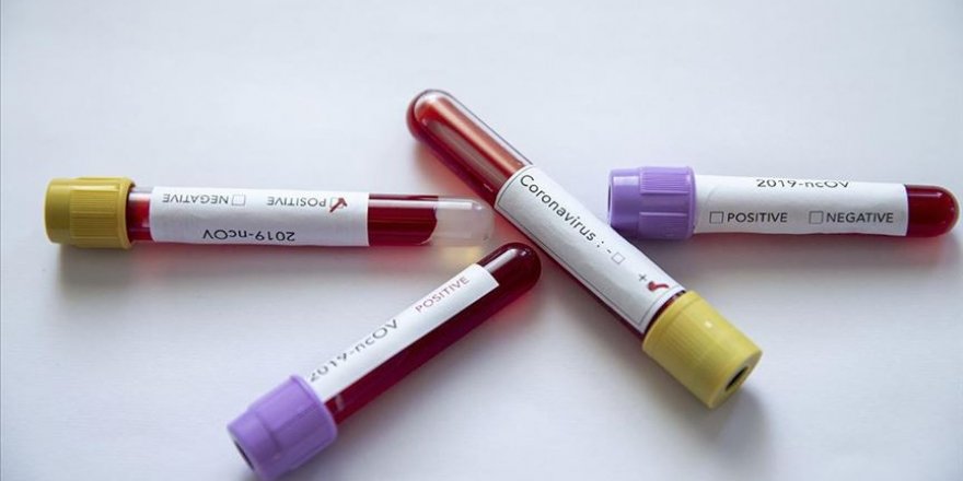 Covid-19'dan 59 kişi daha hayatını kaybetti, bin 832 yeni tanı kondu