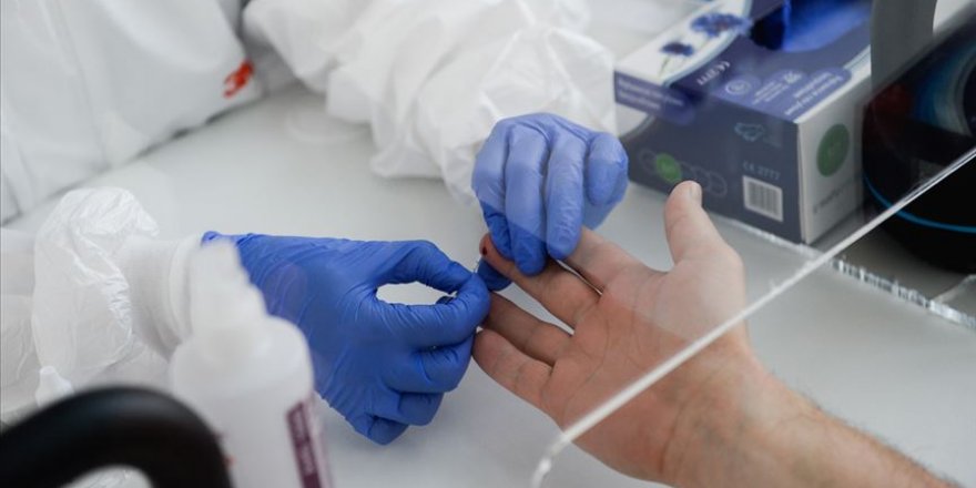 Ege Üniversitesi'nde 4 binden fazla örnek üzerinde antikor testi yapılacak