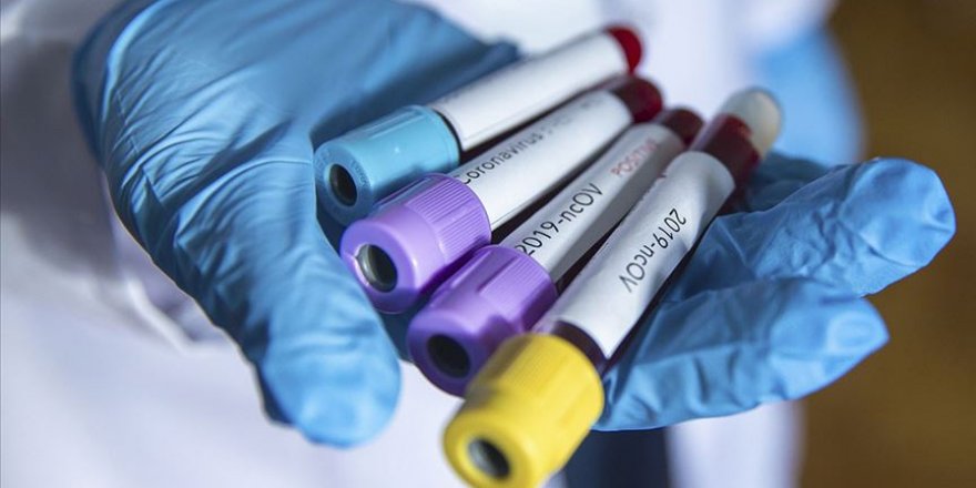 Çocuklarda Kovid-19'un ilk belirtisi sindirim sistemi semptomları olabilir