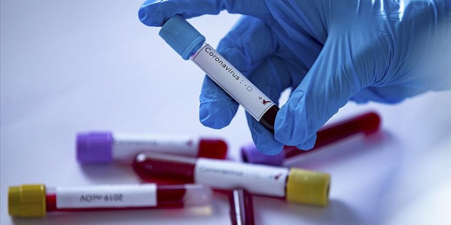 Koronavirüste obezite tehlikesi