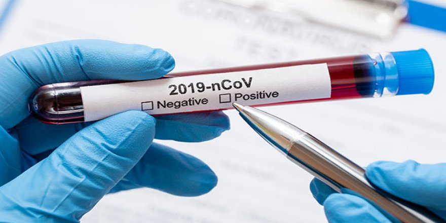 Türkiye'den gönderilen 20 bin test kiti Gazze'ye ulaştı