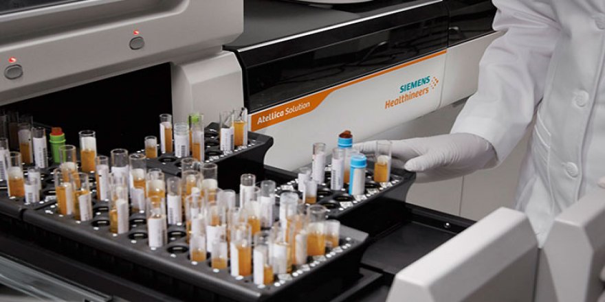 Koronavirüse karşı bağışıklığın gücünü ölçen test kiti geliştirildi