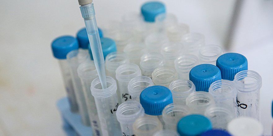 Kovid-19 tedavisinde kullanılan ilaçların izotopları yerli imkanlarla sentezlenecek