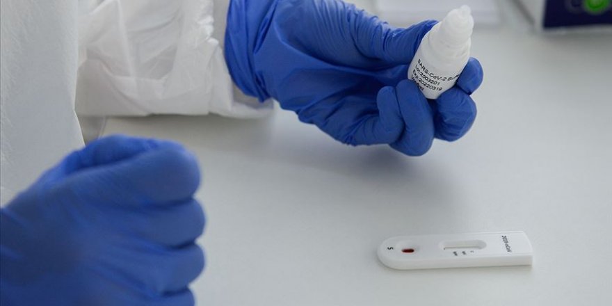 Antikor seviyesinden anlam çıkarmak doğru değil