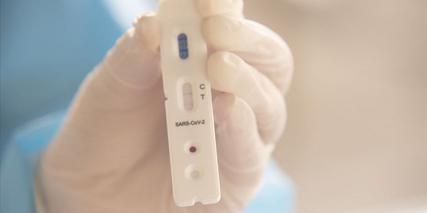 15 dakikada sonuç veren test kiti Avrupa’da kullanılacak