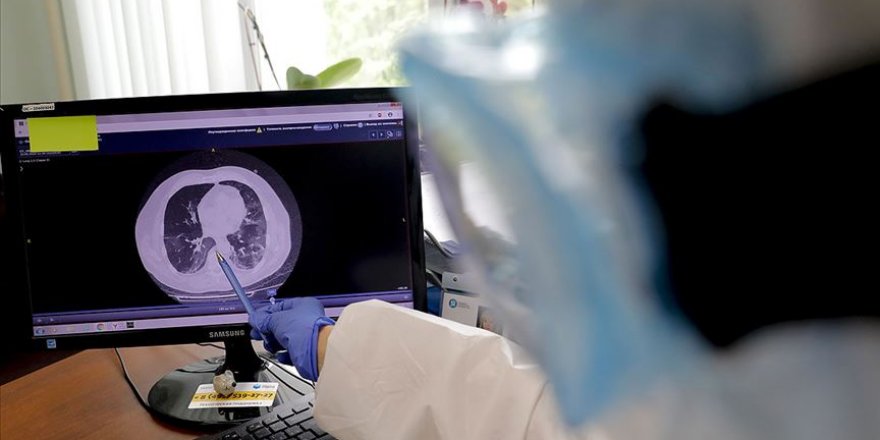 Yeni bir araştırma, motor nöron hastalığının bazı mevcut ilaçlarla tedavi edilebileceğini gösterdi