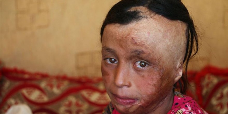 İç savaşın silinmeyen hafızası: Suriyeli çocuklar