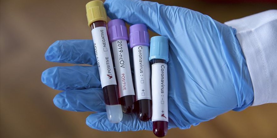 Suudi Arabistan'da Kovid-19 vaka sayısı 100 bine yaklaştı