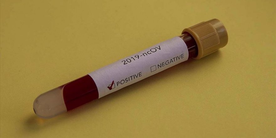 Çin'in Kovid-19 konusunda DSÖ'yü geç bilgilendirdiği eleştirisi