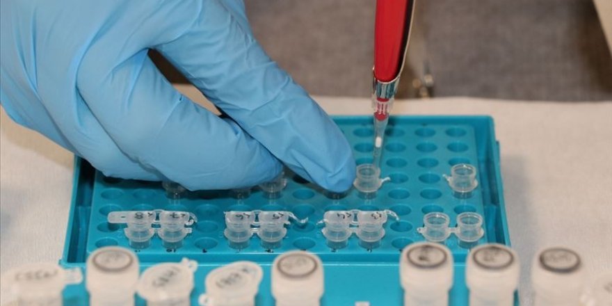 Yüksek kortizol seviyesi Kovid-19 hastalarında ölüm riskini artırabilir