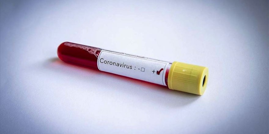 Madagaskar Kovid-19'a karşı bitkisel ilaç üretecek