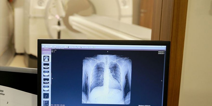 Akciğer kanseri tedavisi için umutlandıran haber