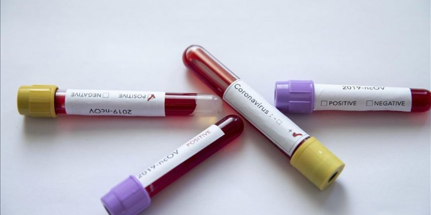 Kolombiya'da Kovid-19'un daha hızlı yayılan türü tespit edildi