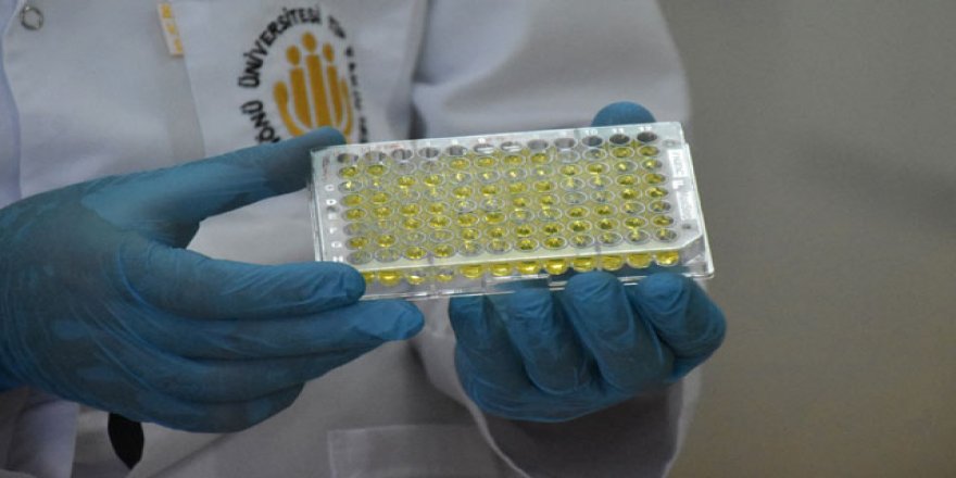 'Covid-19'dan iyileşenlerin kardiyak kontrollerinin yapılması gerekiyor'