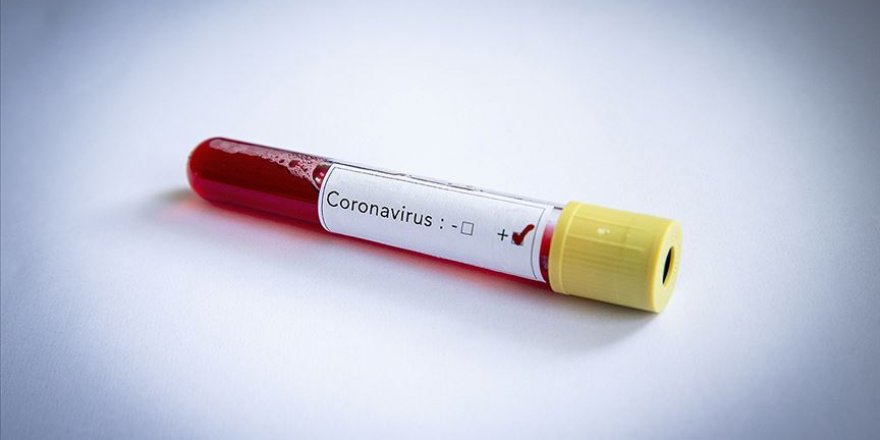 Kovid-19 tedavisinde 'hidroksiklorokin' ilacı kullanılmayacak