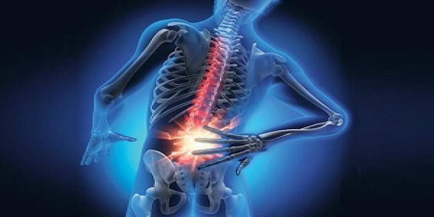 Skolyoz hastalığına kız çocuklarda daha fazla rastlanıyor