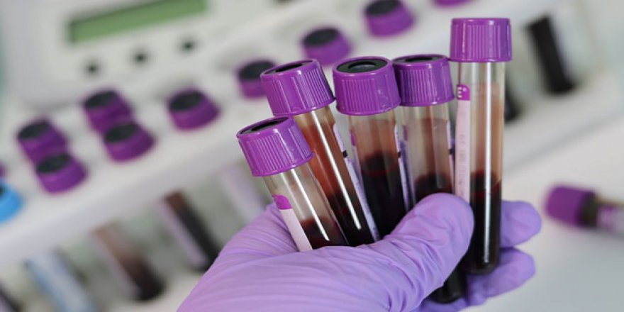 Kan grubu A olanların Kovid-19'a yakalanma riski daha yüksek olabilir