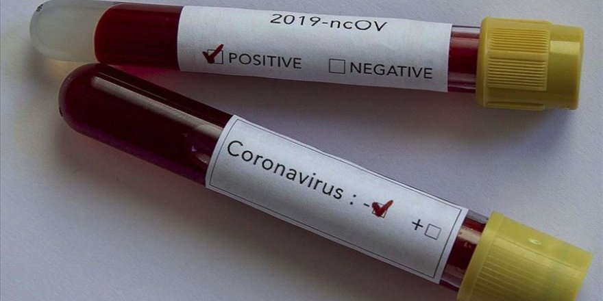 81 ile koronavirüs genelgesi