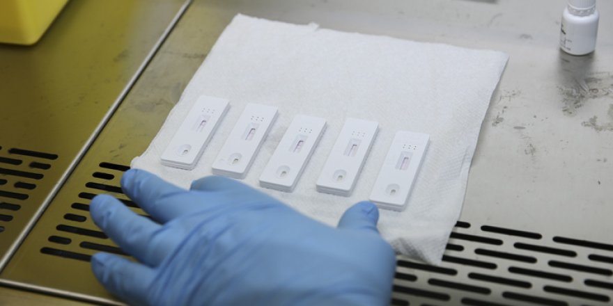 21 ülkeye ürettiği Kovid-19 tarama testini sattı