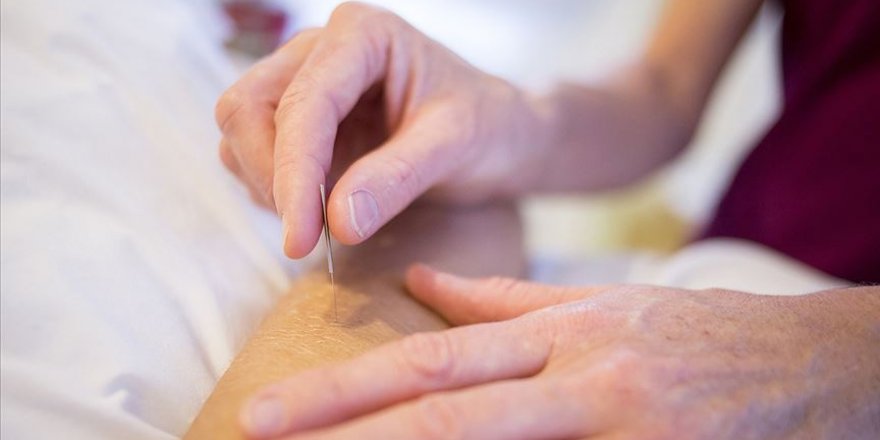 Kovid-19'un etkilerini hafifletmede akupunktur ümit veren bir tedavi yöntemi olabilir