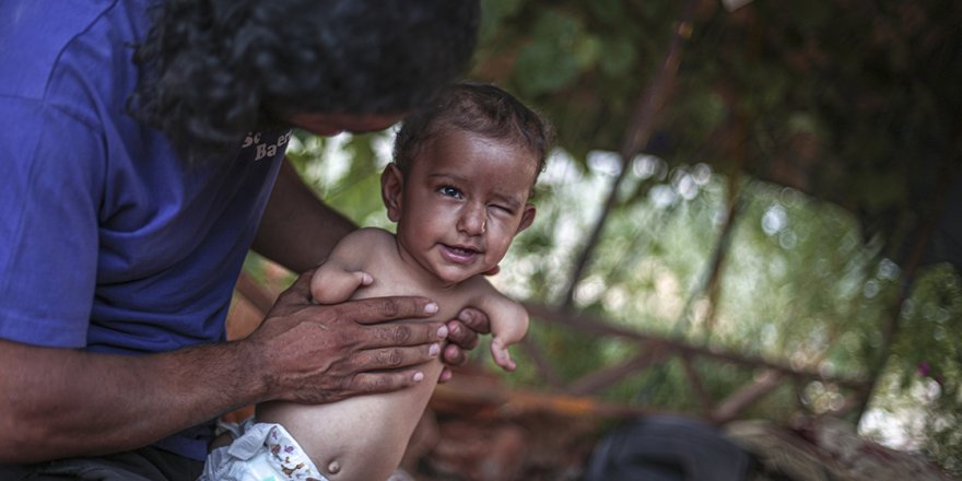 Uzuvları olmayan Muhammed bebek tutunacak bir hayat arıyor