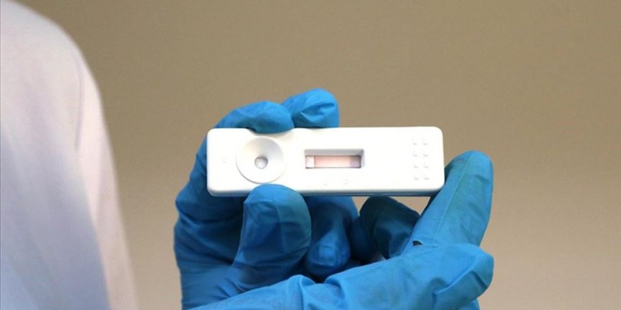 ÇOMÜ’de 8 dakikada koronavirüs tanısı koyan kit geliştirildi